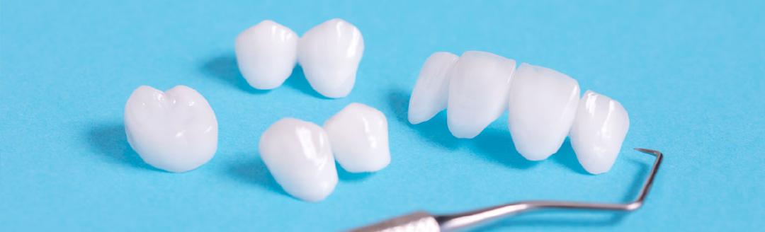 Veneers and a dentist root pick are on a blue surface