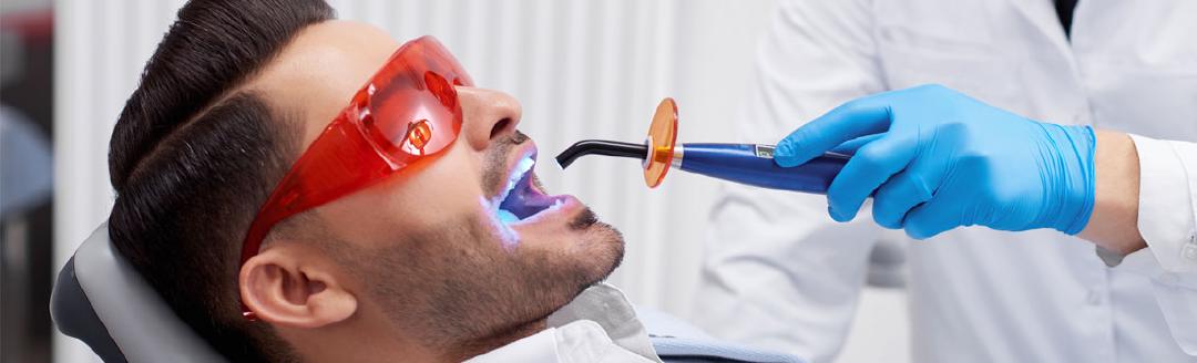 A man's teeth are being whitened at the dentist's office